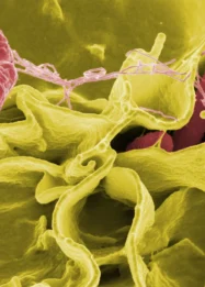 Mengenal Bakteri Salmonella: Cara Penyebaran, Risiko Kesehatan, dan Upaya Pencegahan Nasional